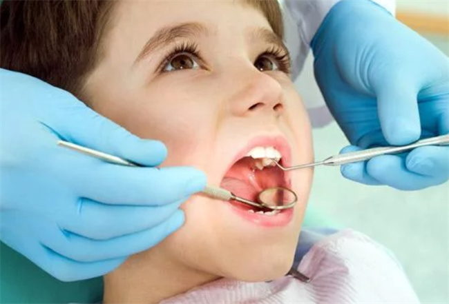 儿童牙齿补牙：三大关键步骤，确保健康笑容的持久绽放