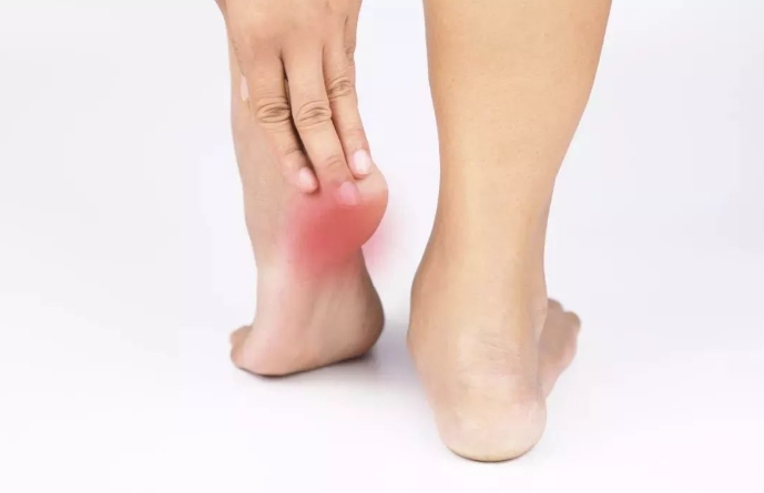 脚后跟疼痛：轻忽不得，及时治疗至关重要
