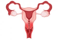产后阴道松弛：原因和防护