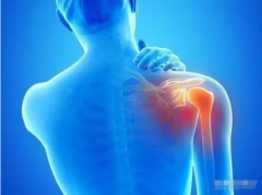 解析肩膀酸痛原因及有效治疗方法