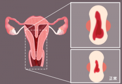 女性健康：月经少且发黑，原因及调理方法全解析