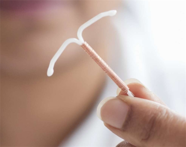 揭秘女性上环的身体影响：了解真相才能更从容