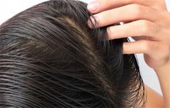 专业护发指南：解锁头发油腻问题的有效洗发秘诀