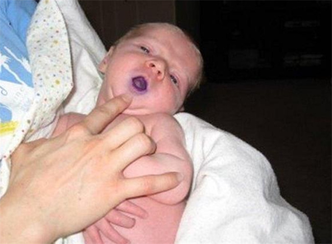 婴儿嘴唇发紫？不慌，这里有科学的关怀指南！