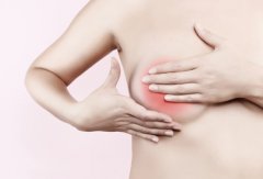 乳腺增生的科学治疗与日常调理指南