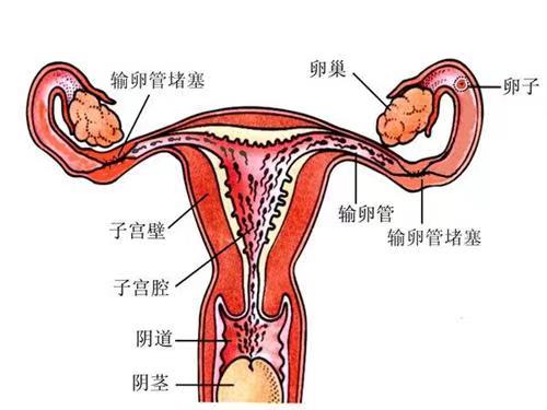 月经异常、阴道出血小心是「输卵管阻塞」，恐会造成不孕或子宫外孕！