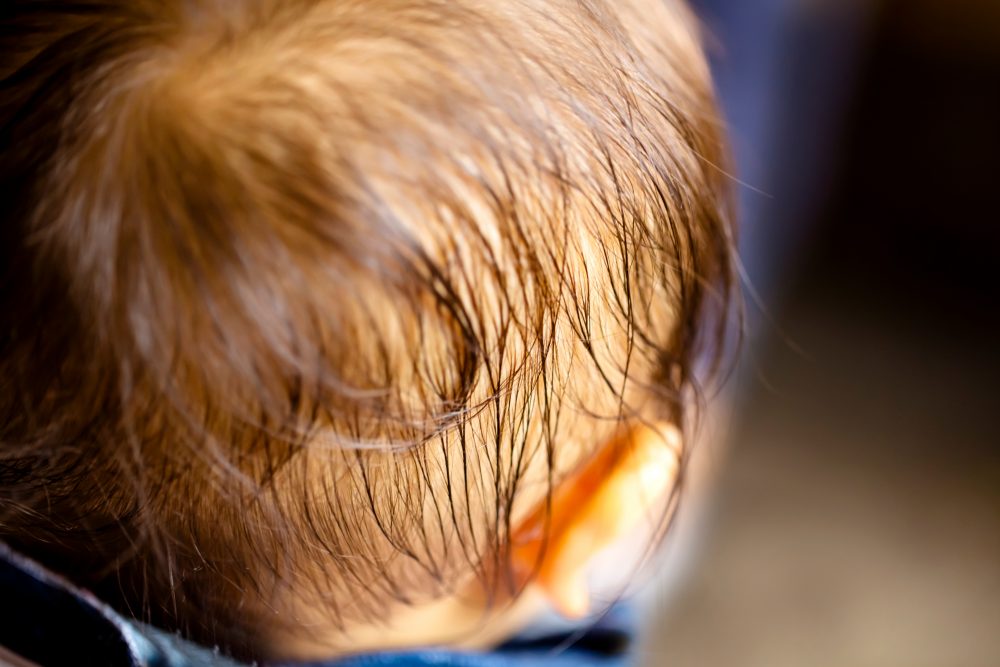为什么6个月大的孩子即使没有生病,也仍然在背部和头部冷汗?