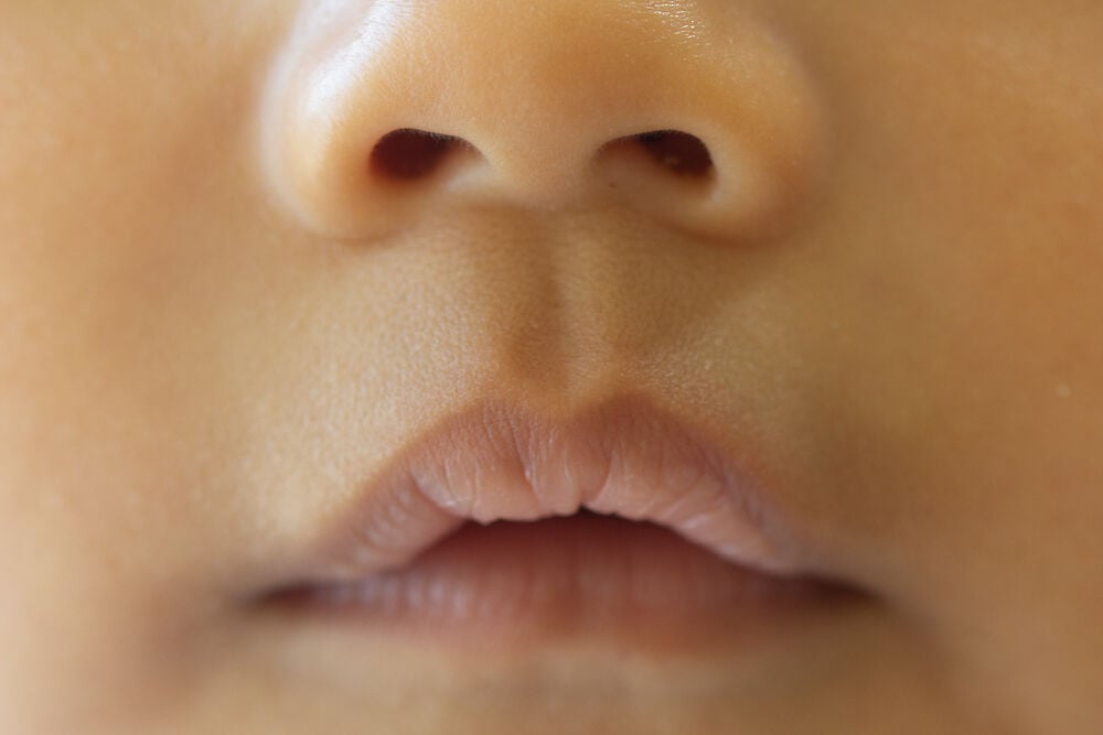 嘴唇深的婴儿必须警告危险的病理吗?