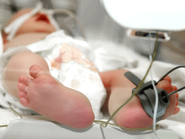 婴儿肺纤维化越小越危险