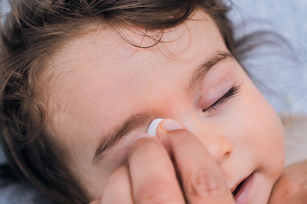 孩子眼睛浮肿是什么原因?父母应该担心吗?