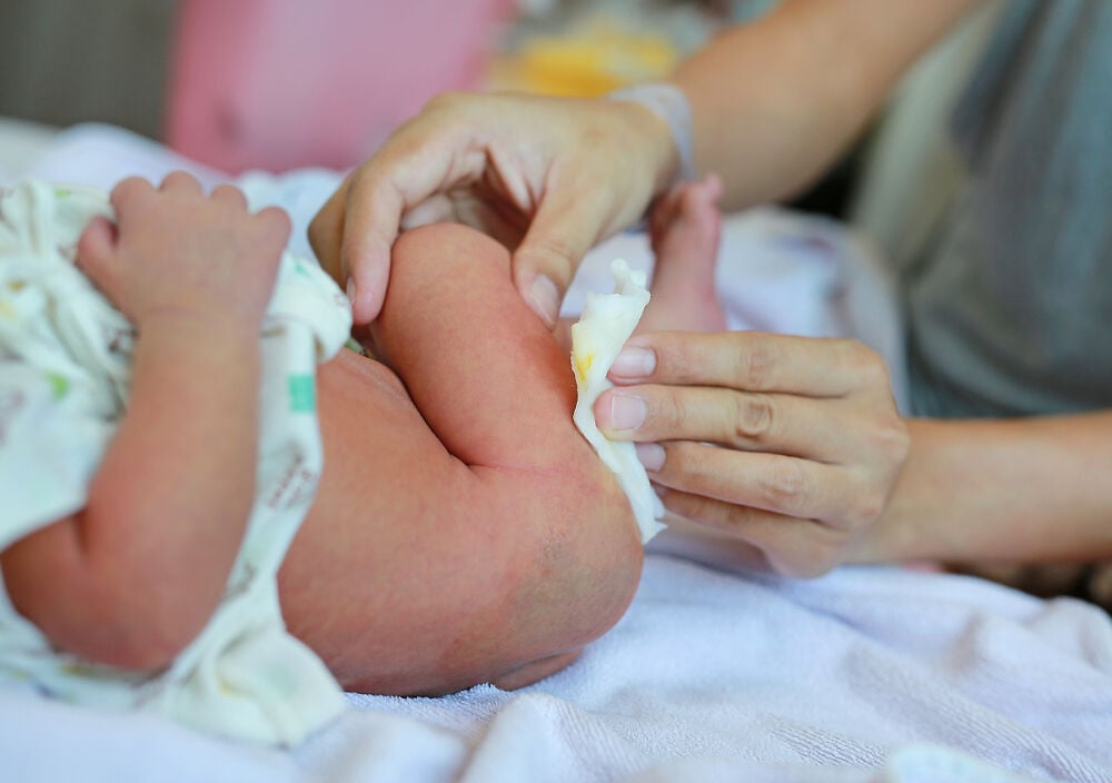 新生儿尿黄是否异常?