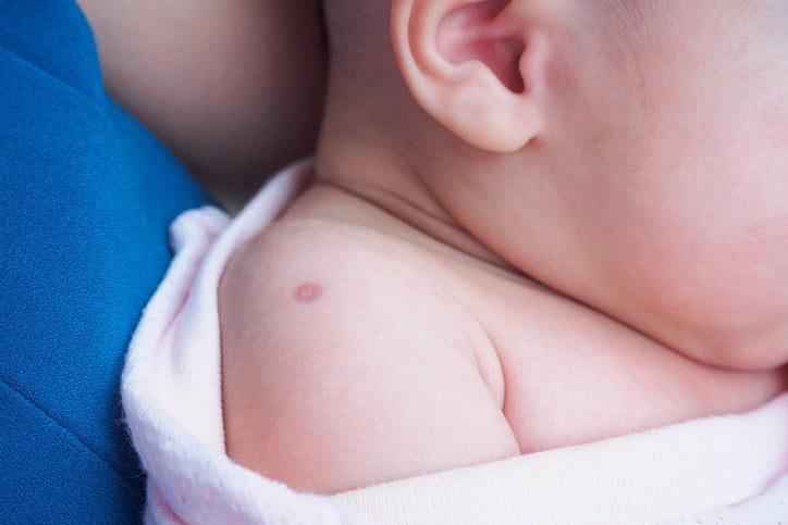 儿童疫苗接种部位应贴上退烧片吗?