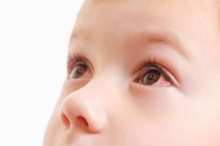 照顾患有眼部感染的孩子,不要忘记以下7个家庭提示