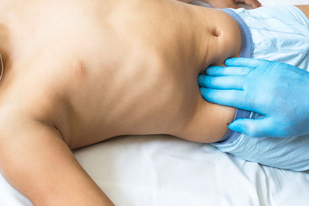 儿童阑尾炎: 体征,原因,治疗