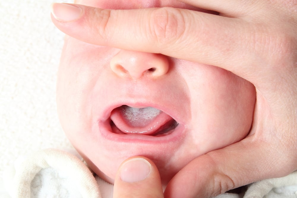 孩子口腔周围有红疹是怎么回事?如何处理