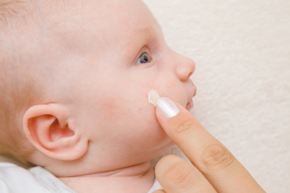 婴儿乳痘多久会结束?治疗方法是什么?