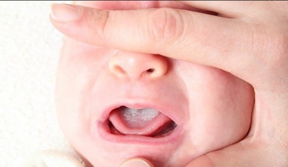婴儿的舌头是如何标准的?