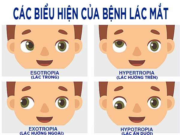 儿童常见眼病及治疗方法