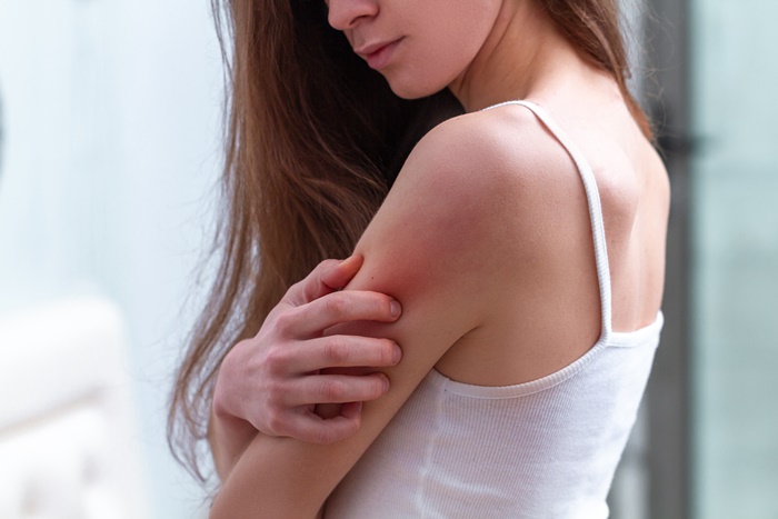 「荨麻疹」怎么止痒？症状为何？皮肤科医师教你3种舒缓方式、止痒饮食技巧