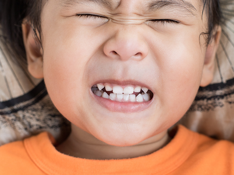 男童拔牙后「牙齿失踪」，咳嗽不止才惊觉不妙