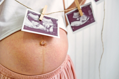 避免再早产！生二胎时，特别安排「子宫颈环扎手术」降低风险