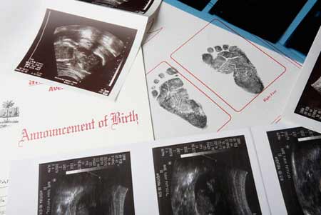 胎儿在子宫内打脸,教你看B超数据读懂胎儿发育是否标准