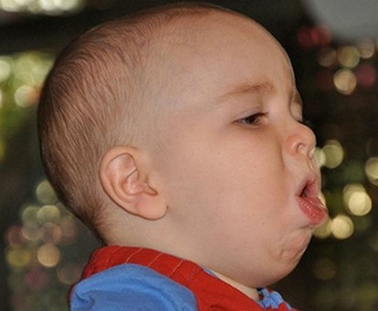 宝宝咳嗽不一定就是感冒：宝宝咳嗽有痰怎么办？