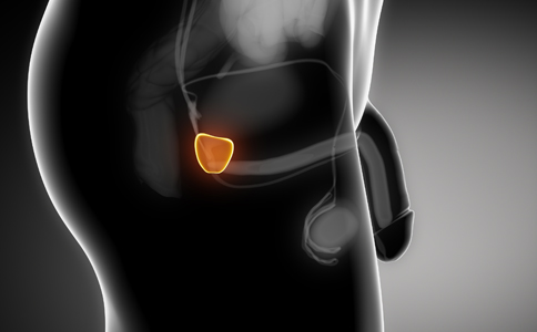 前列腺结石怎么检查?前列腺结石检查方法?如何预防前列腺结石