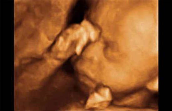 腹中胎儿动作发展活泼好动