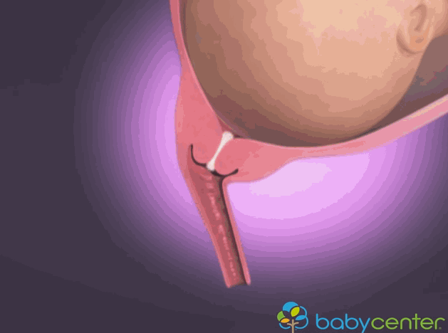 动图描绘分娩的过程，宝宝是如何生出来的？