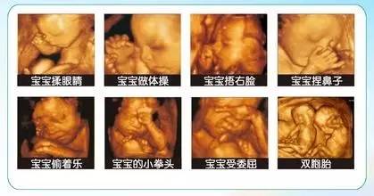 孕期B超、三维彩超、四维彩超  准妈们怀孕期间不同超声检查要会区分