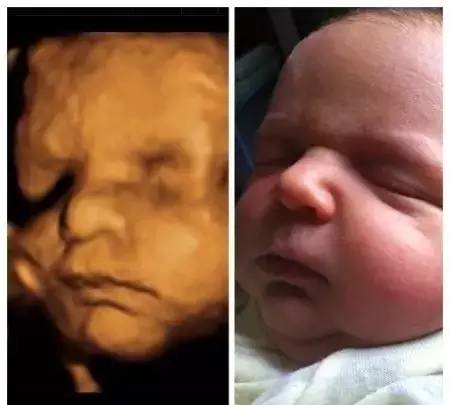 一张胎儿B超图，竟被点击百万次，太有爱了！