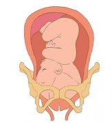 胎儿不入盆：胎儿不入盆的原因是什么