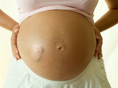 问：胎动时宝宝到底是不舒服还是舒服呢？