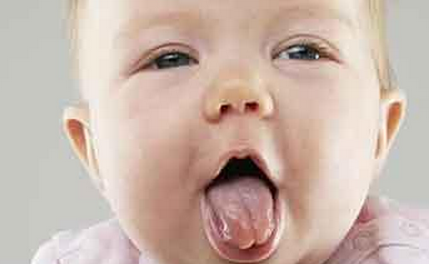 婴儿舌苔厚白是怎么回事