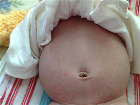宝宝胀气可以贴肚脐贴吗 丁桂儿脐贴能有效缓解肚子胀气