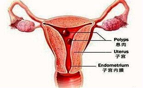 子宫内膜过厚或过薄,都可能会导致月经不调,切勿大意