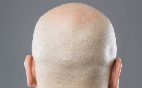 徐峥自曝20岁秃顶 造成男性秃顶的原因有哪些