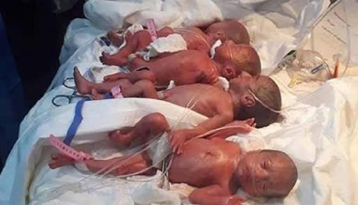 女子顺产七胞胎什么情况：详情真相揭多胞胎怎么形成的