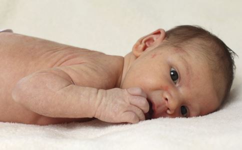 宝宝老是频繁长湿疹到底是何原因，要怎么办？