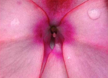 女性阴部真实照片：详解女人真实完美阴道图片【多图】