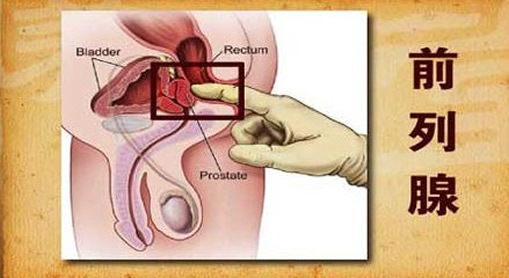 前列腺病自我按摩图解：手把手教你按摩前列腺方法