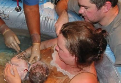 水下分娩是一种什么体验：所有孕妇都能水下分娩吗