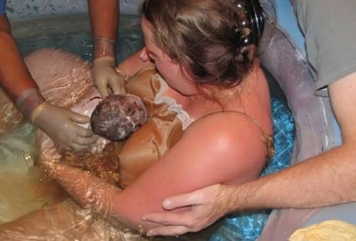 水下分娩是一种什么体验：所有孕妇都能水下分娩吗
