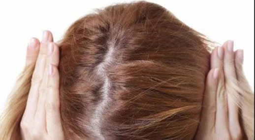 女人掉头发是什么原因：老掉头的各种原因汇总