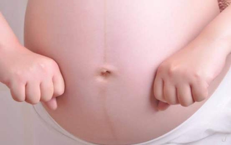 很准!怀孕肚子一条线知男女,肚子黑线不直是男孩吗?