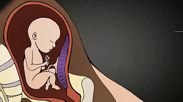 一组漫画告诉你堕胎有多恐怖！（少儿勿进！）