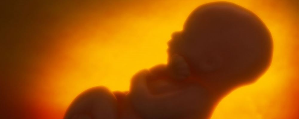 男婴腹中藏寄生胎 形成寄生胎的原因