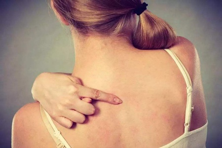 孕妇皮肤瘙痒的四大原因,孕妇快速止痒小偏方