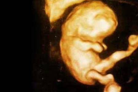 孕早期前两个月胎儿有多大 准妈妈肚子会有哪些症状